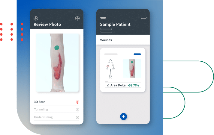 Wound Analytics