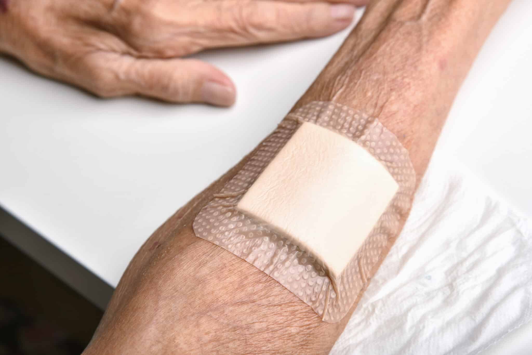 man covers a wound at home for wound care after staples are removed
