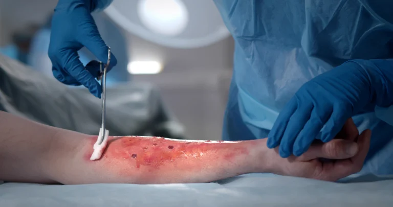 A patient with a traumatic wound receives debridement from a surgical team