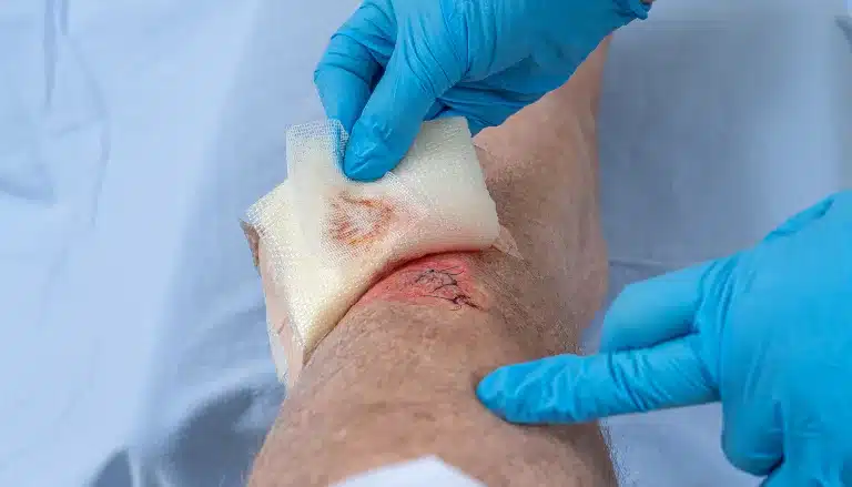 practitioner cleans a wound in everyday practice