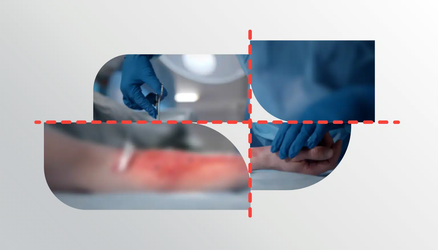 Deconstructing the Chemical Burn: What to Know & How to Treat Them